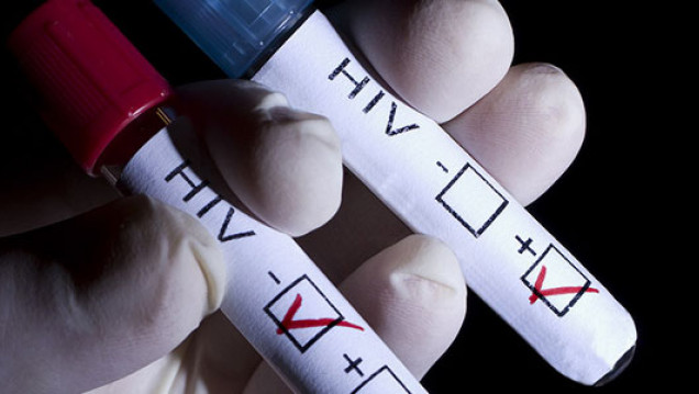 imagen Realizarán testeos gratuitos de VIH para estudiantes