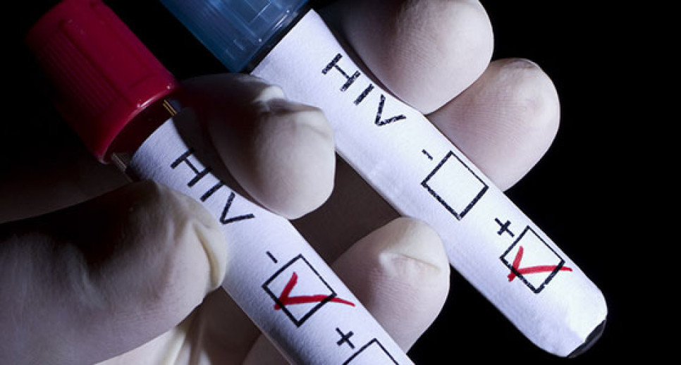 imagen Realizarán testeos gratuitos de VIH para estudiantes